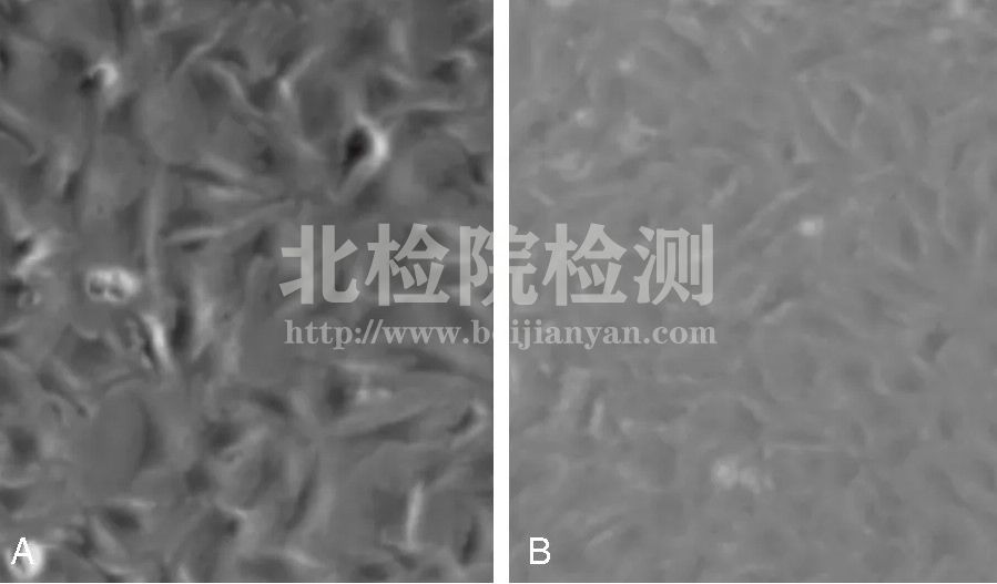 乳鼠成骨細(xì)胞培養(yǎng)實(shí)驗(yàn)