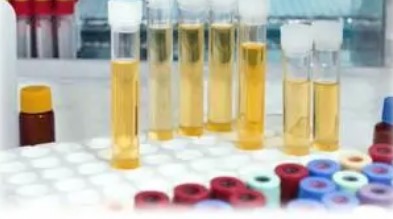 生物標志物測定