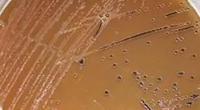 鼠傷寒沙門氏菌試驗