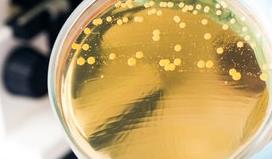 藥物敏感性檢測